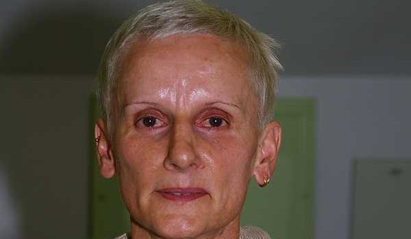 NF1: Corinne BENINTENDI, une grande dame du basket !!